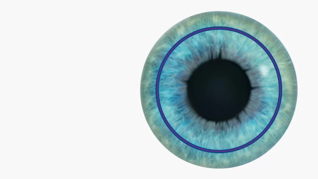 The Evolution of Laser Vision Correction Techniques