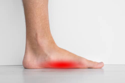 3 Symptoms of Plantar Fasciitis