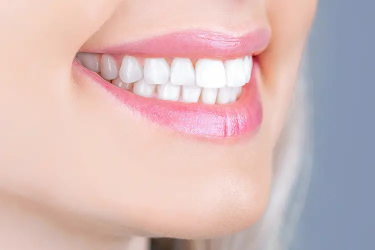 Brighten Your Smile: What to Expect from a Teeth Whitening Session