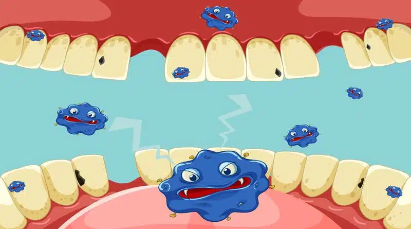 Cavity Prevention and Treatment