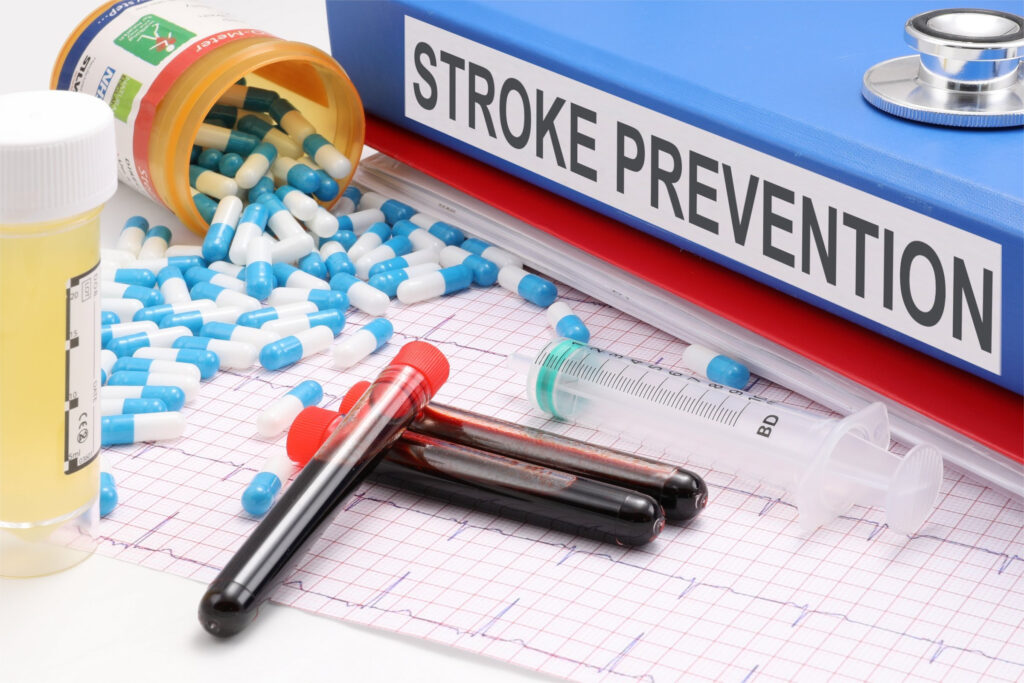 Effective Strategies for Stroke Prevention