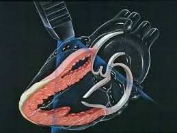 How Does a Cardiologist Treat Chest Pain