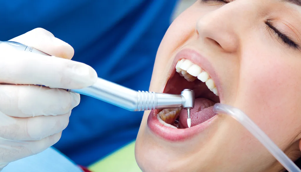 How Often Should You Schedule a Teeth Cleaning Exam?
