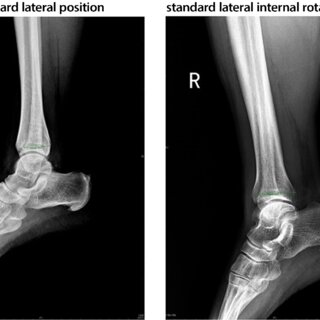 How a Podiatrist Can Help with Foot and Ankle Injuries