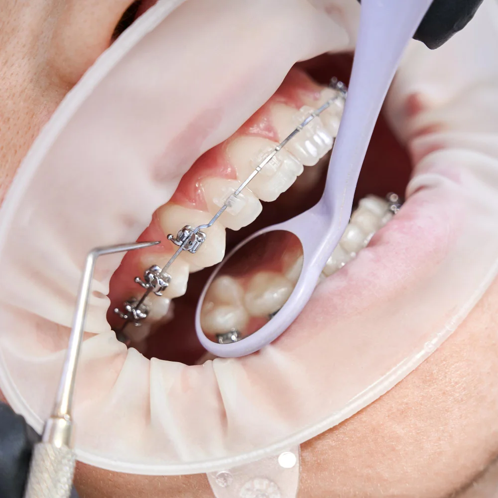 Tips for Taking Care of Your Teeth Between Dentist Visits