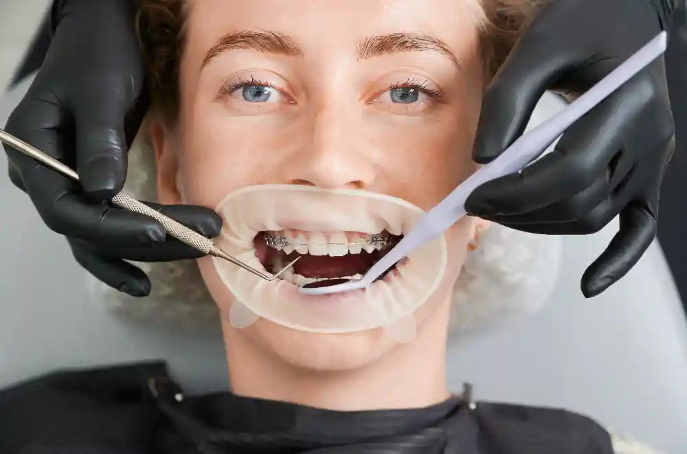 What Is the First Sign of Wisdom Teeth