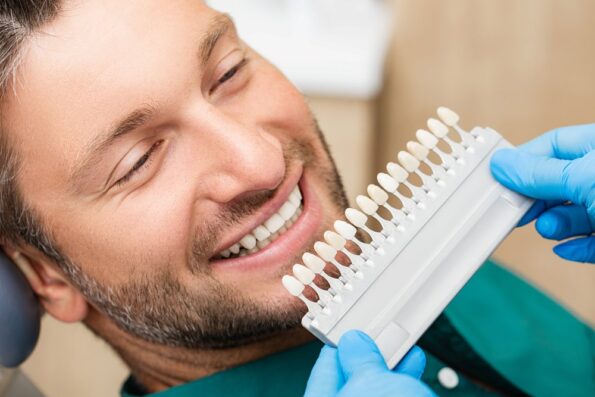 Common Myths About Veneers Debunked