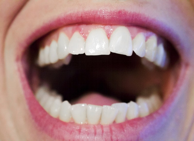 What Are the Risks and Benefits of Teeth Whitening Procedures?