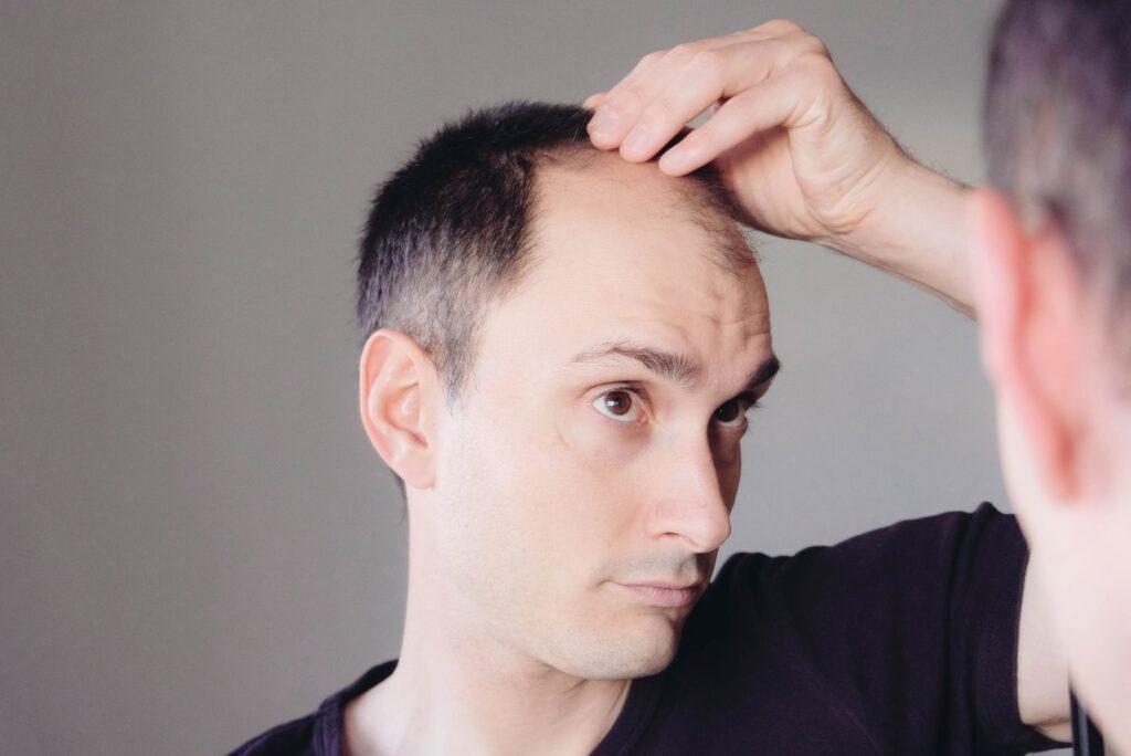 What Is the Process of Hair Restoration?