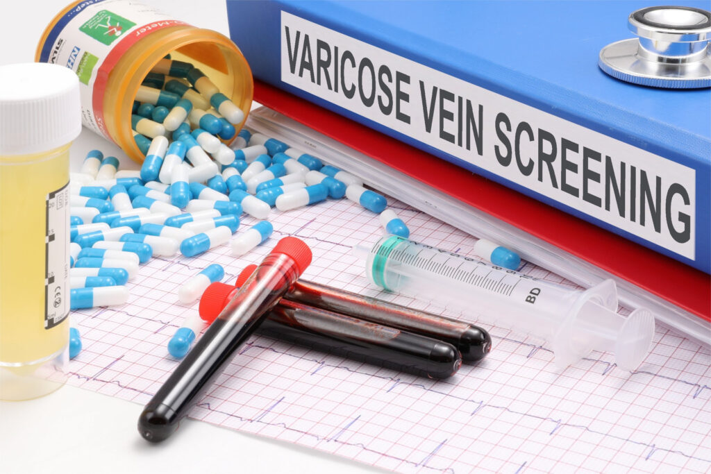 When To Seek Medical Help for Varicose Veins