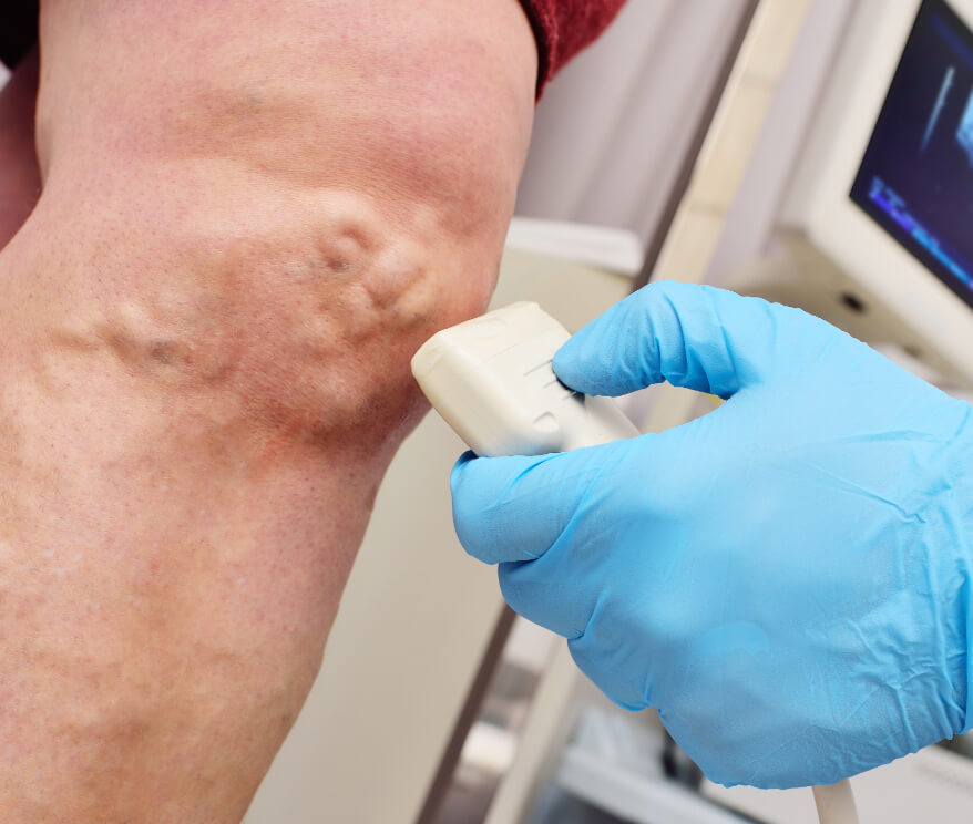 Wound Care Tips for Managing Chronic Injuries