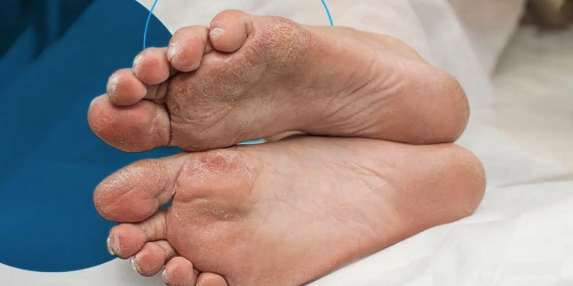 Choosing the Right Podiatrist for Your Foot Health Needs